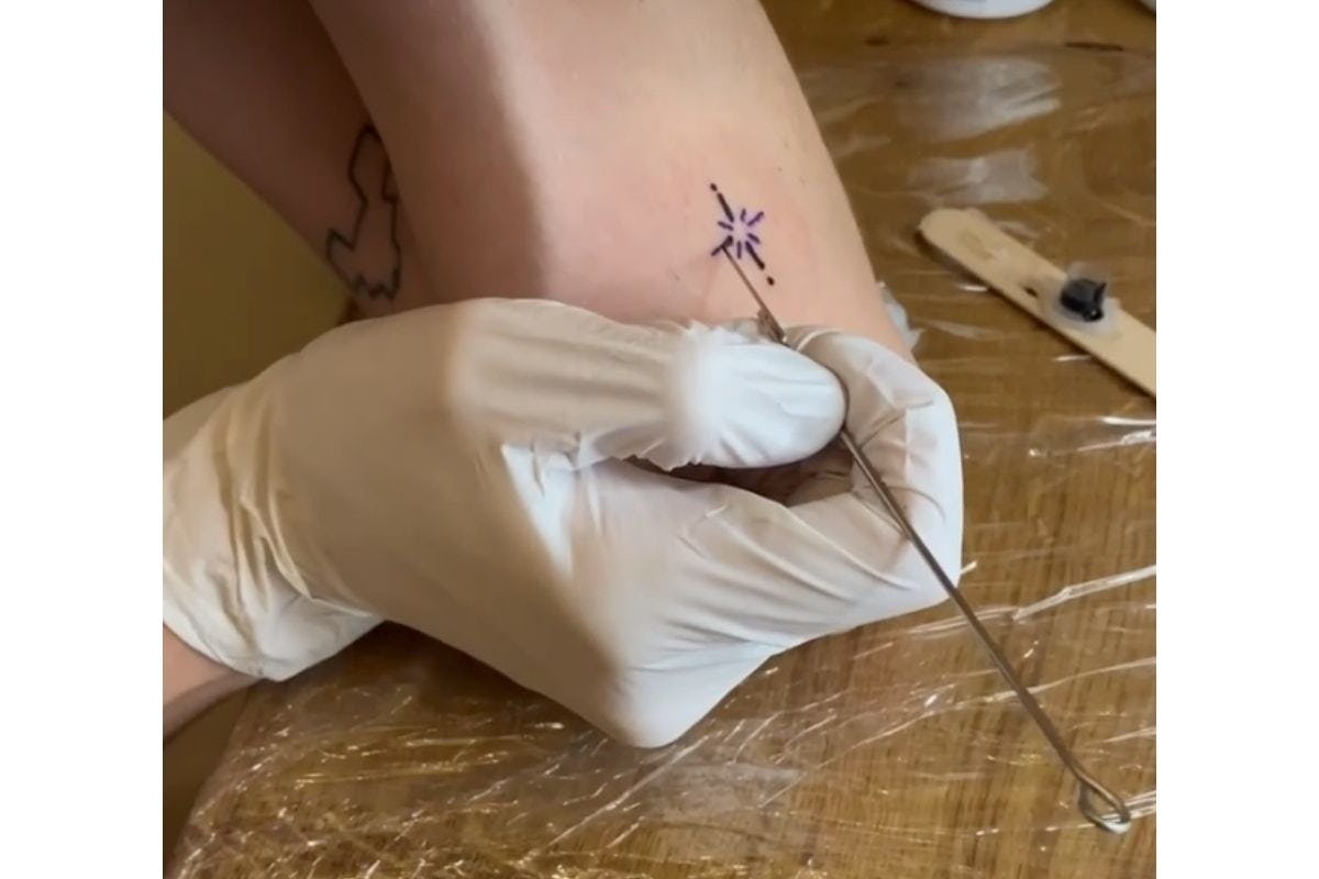 tecnica del hand poked