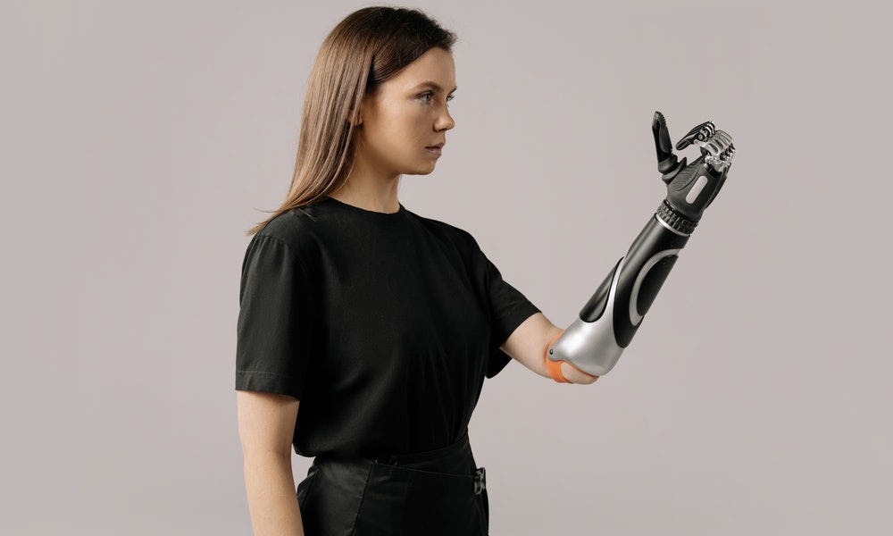 Prótesis cómo uno de los lugares en dónde se puede aplicar la inteligencia artificial