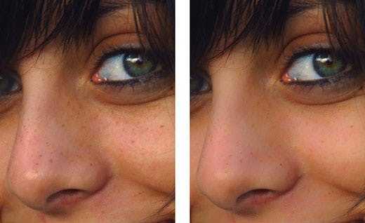 corregir suavizar piel 