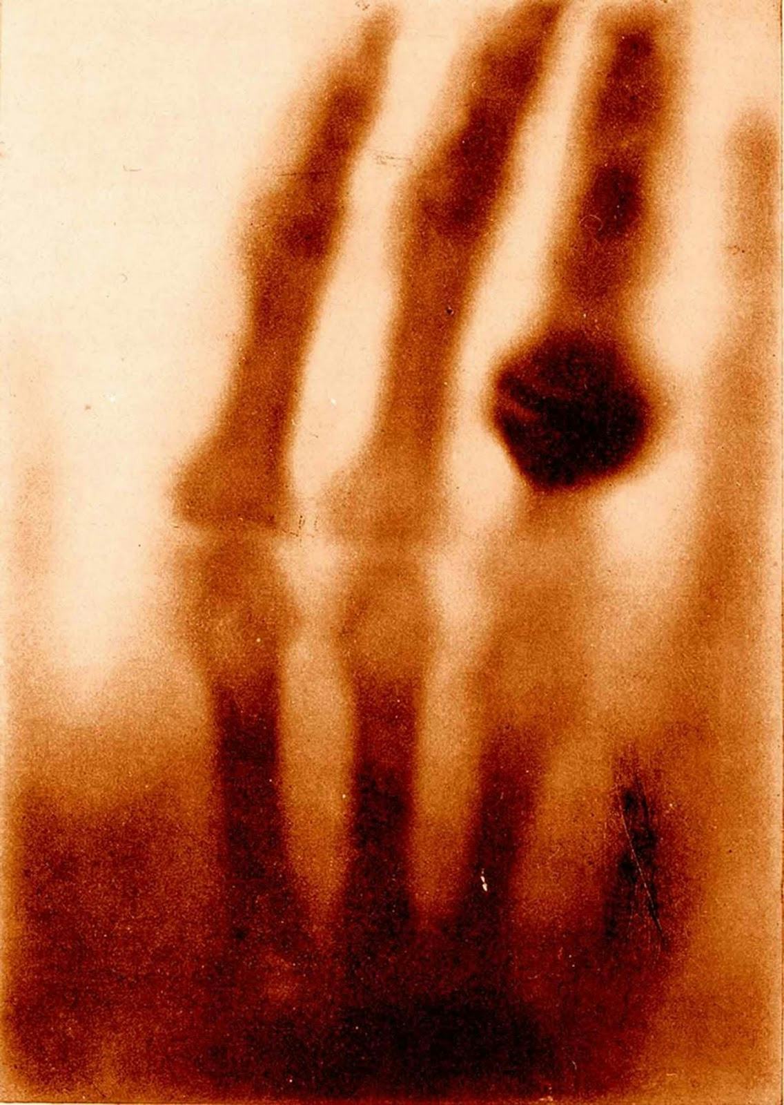 fotos de radiografias